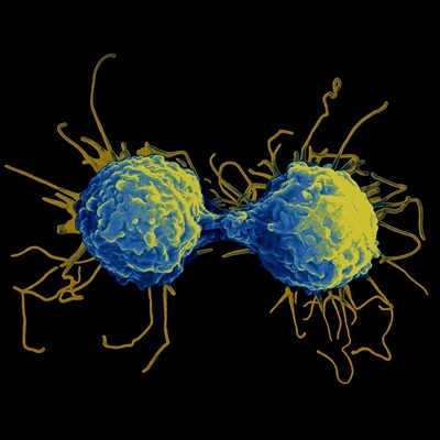 T淋巴细胞